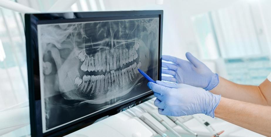 CBCT imaging technology