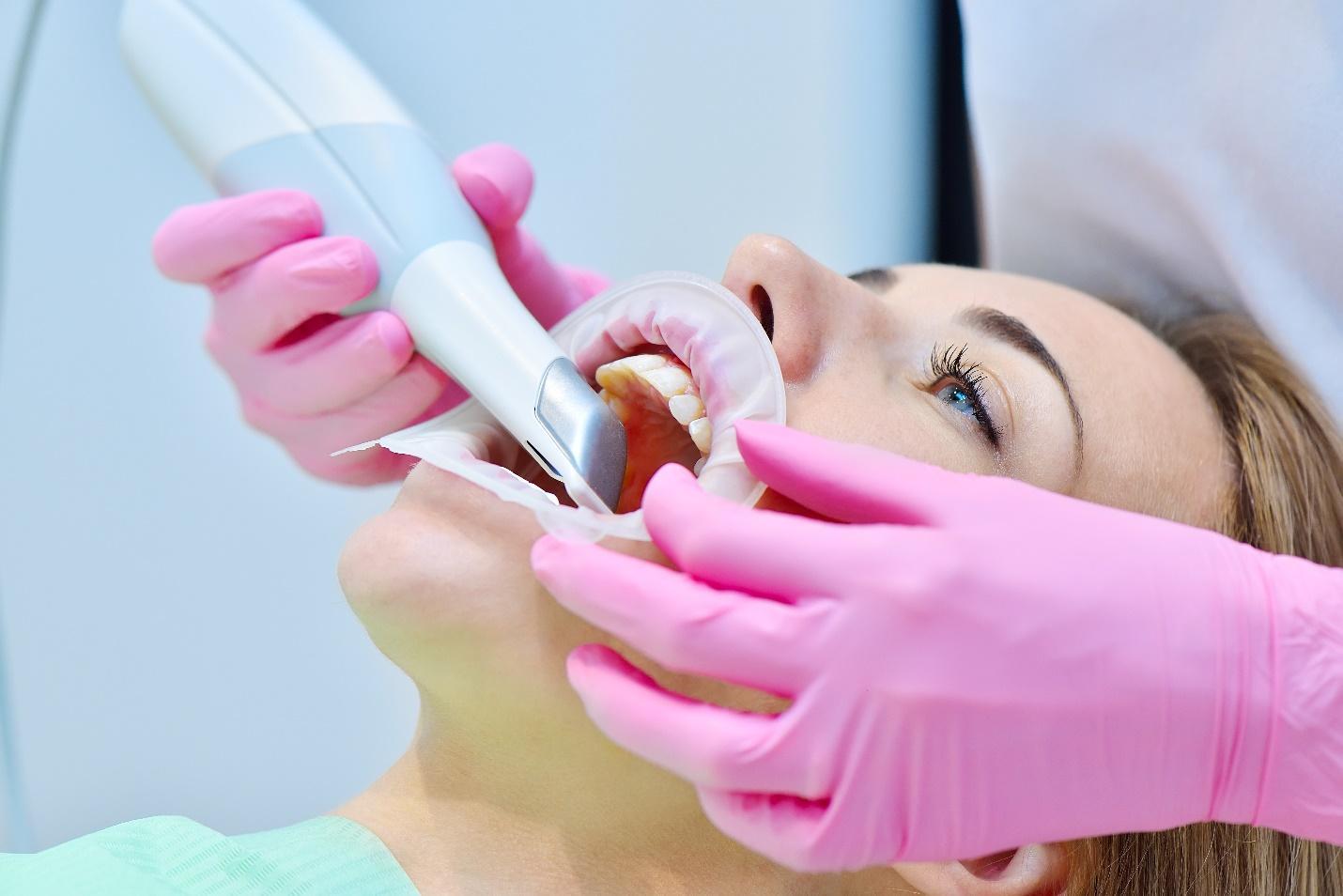 Intraoral scanner in use