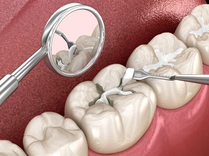 CBCT imaging technology